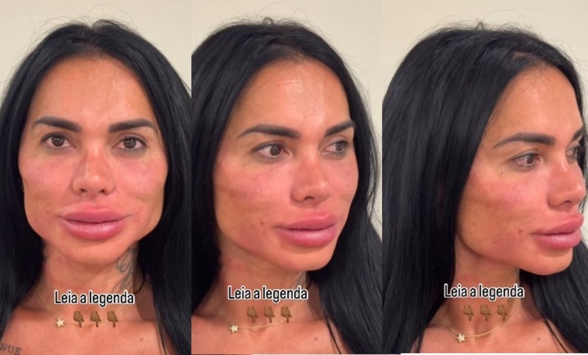 Kamila Simioni explica se foto de harmonização facial é verdadeira e faz deboche