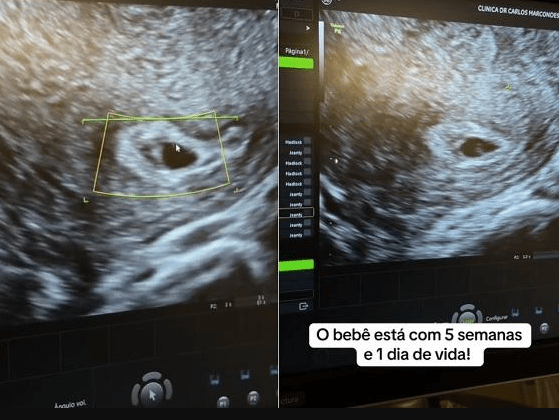 Maíra Cardi exibe ultrassom do filho Maíra Cardi exibe ultrassom do filho