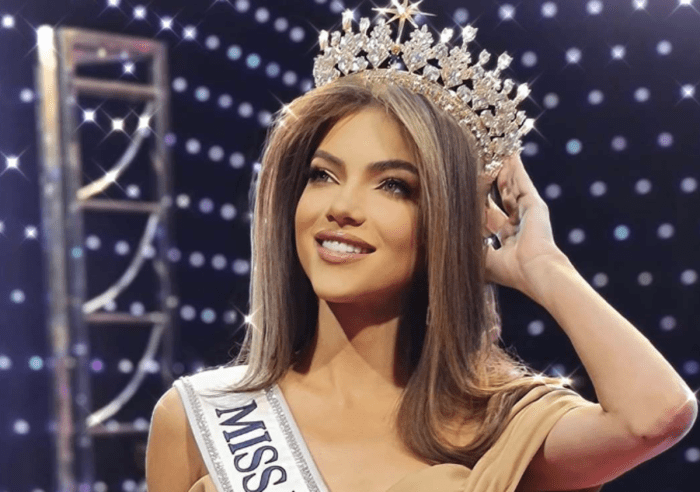 Mara Topic usa perucas desde que perdeu os cabelos por causa de doença