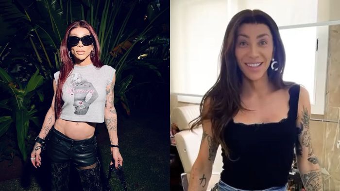 Maya Massafera mostra antes e depois de cirurgia