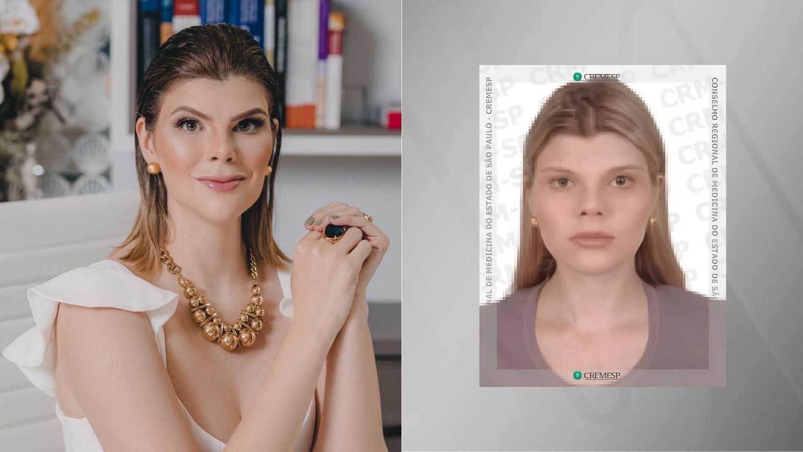 Mulher que fez cirurgia após falso diagnóstico de câncer diz que 'maior cicatriz foi psicológica'