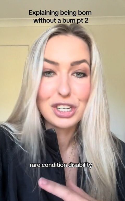 Dessa forma, a modelo precisou fazer sua primeira cirurgia aos sete meses. Dessa forma, a modelo precisou fazer sua primeira cirurgia aos sete meses.