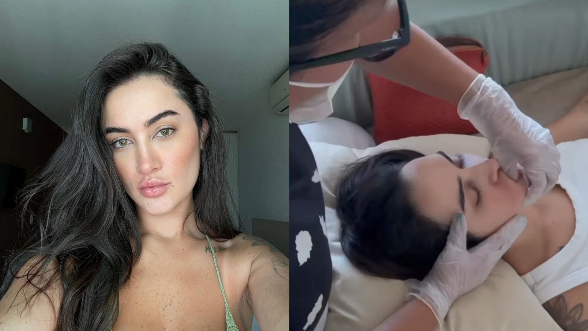 Gabi Melim mostra rotina de fisioterapia após diagnóstico de paralisia facial: ‘três vezes ao dia’
