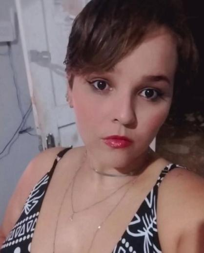 Mulher tem lábio arrancado por cachorro e passa por cirurgia de reconstrução.