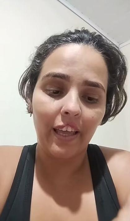 Mulher tem lábio arrancado por cachorro e passa por cirurgia de reconstrução.