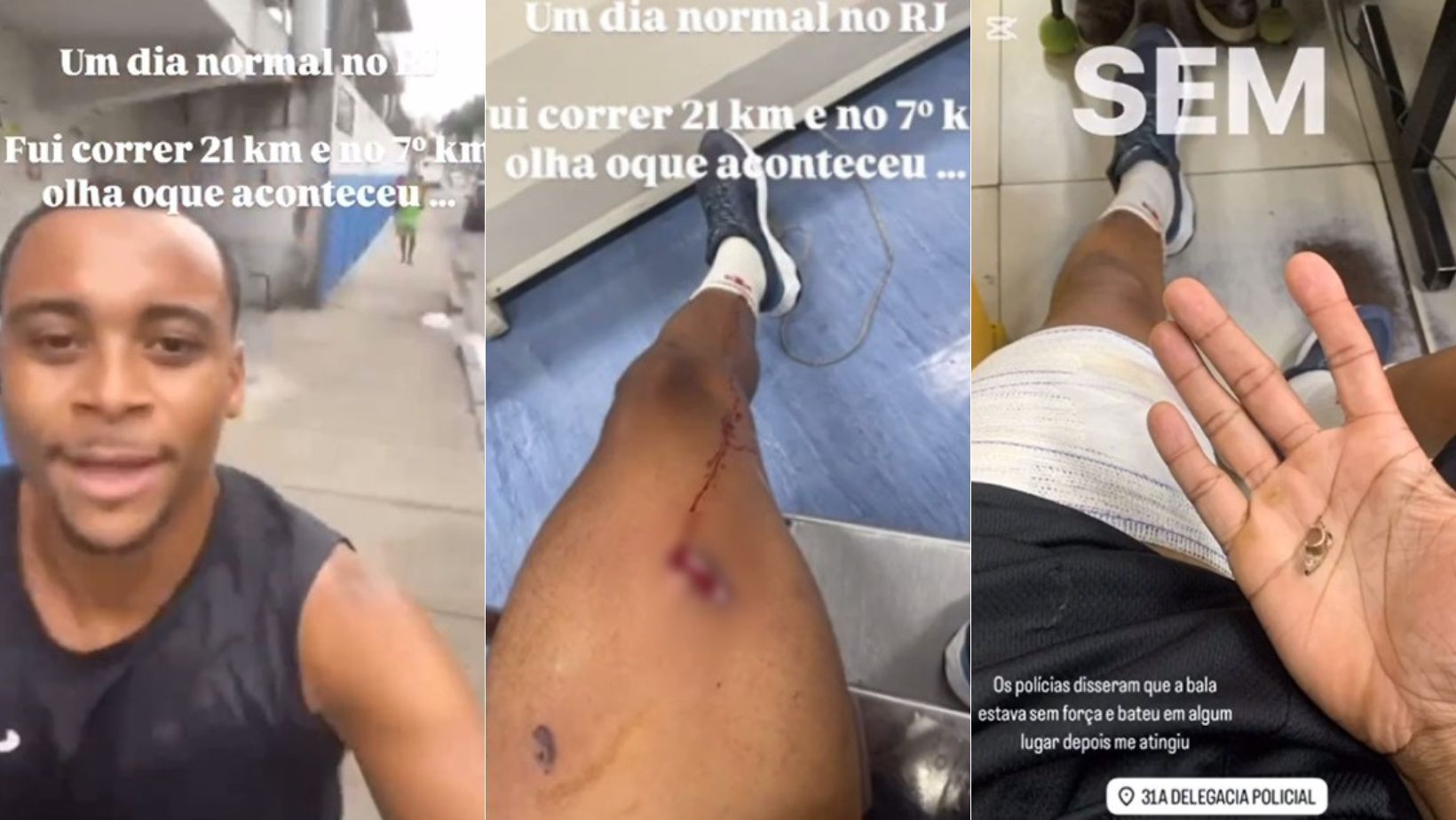 Jovem é baleado na perna enquanto filmava corrida em rua no RJ; veja vídeo