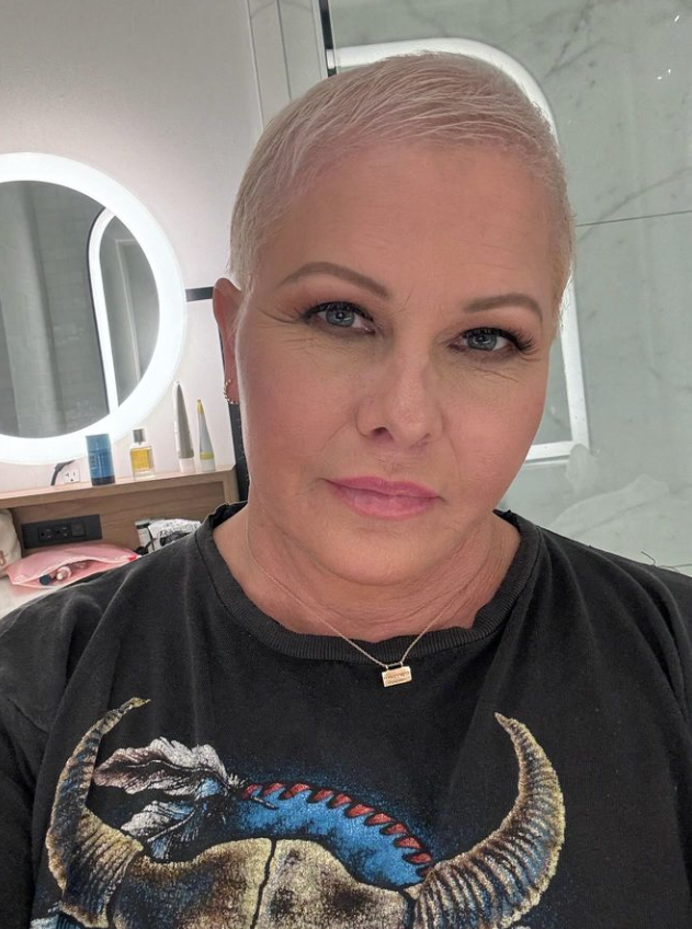 Nicole Eggert aguarda próxima fase do tratamento contra câncer de mama 