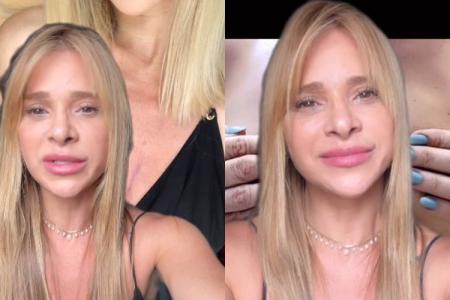 Dany Bananinha relata ter descoberto nódulos nos seios e cirurgia para a retirada