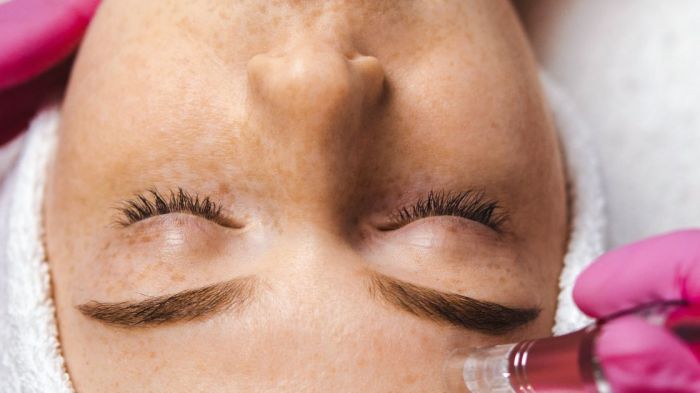 Peeling confira os tipos e os benefícios para pele