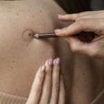 Qual a diferença entre pinta e melanoma? Médica responde principais dúvidas