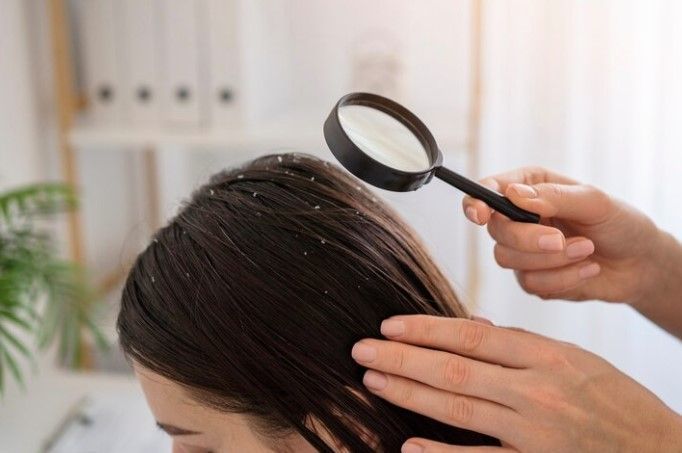 Mulher vai a salão fazer mega hair, pega piolho, entra na Justiça e ganha indenização
