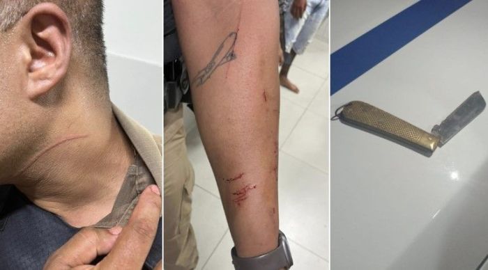 Imagem mostra sargento ferido no pescoço e no braço 