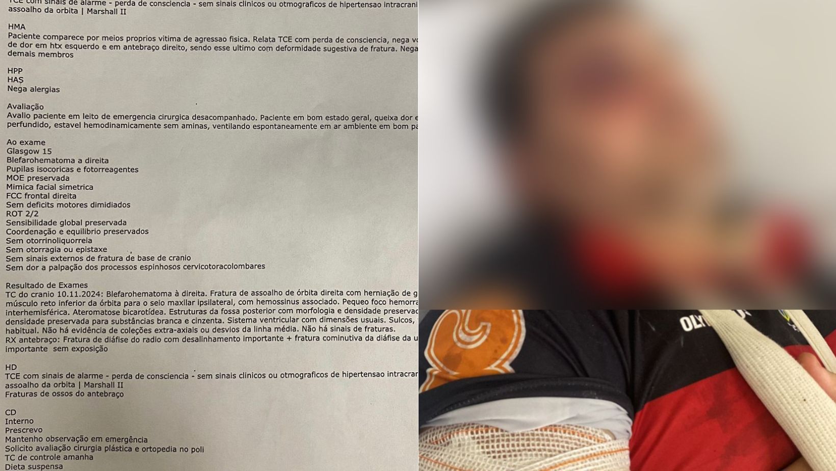 Relatório cita gravidade do quadro de flamenguista espancado por atleticanos em BH