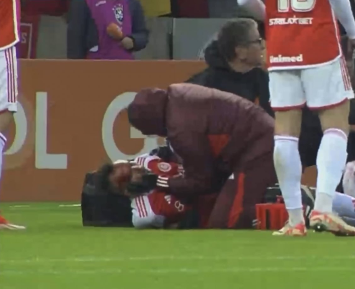 Imagens mostram torcedor desacordado e com muito sangue no rosto