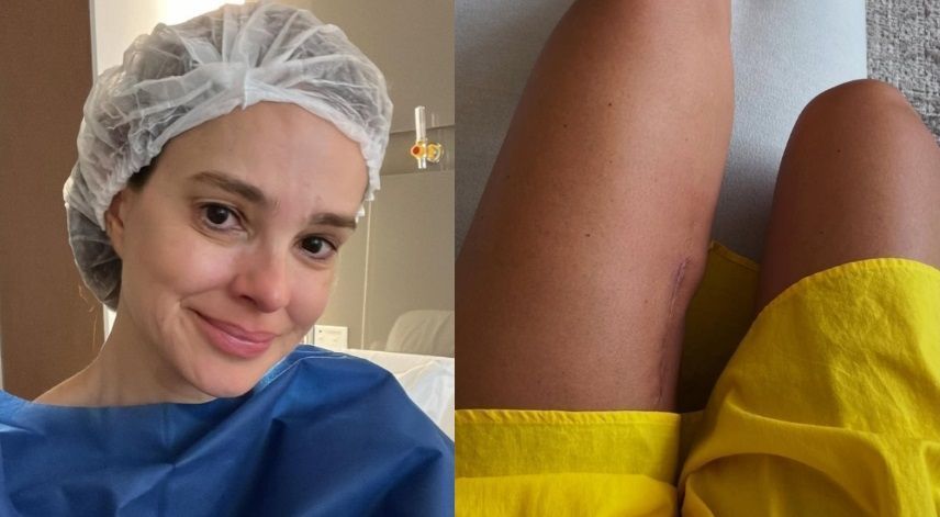 Vera Viel exibe cicatriz e detalha tratamento contra câncer: 'o processo é dolorido'