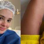 Vera Viel exibe cicatriz e detalha tratamento contra câncer: 'o processo é dolorido'