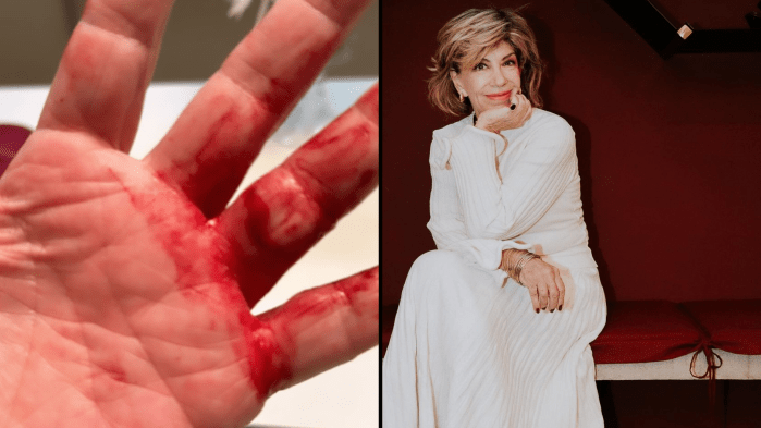 “Quase arrancaram minhas mãos“, conta apresentadora Silvia Poppovic após assalto | CNN Brasil “Quase arrancaram minhas mãos“, conta apresentadora Silvia Poppovic após assalto | CNN Brasil