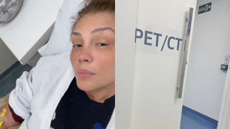 Simony em exame de acompanhamento pós-câncer