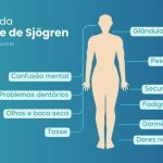 Fabiana de Lemos | Quero chorar, mas não tenho lágrimas; conheça a síndrome de Sjögren