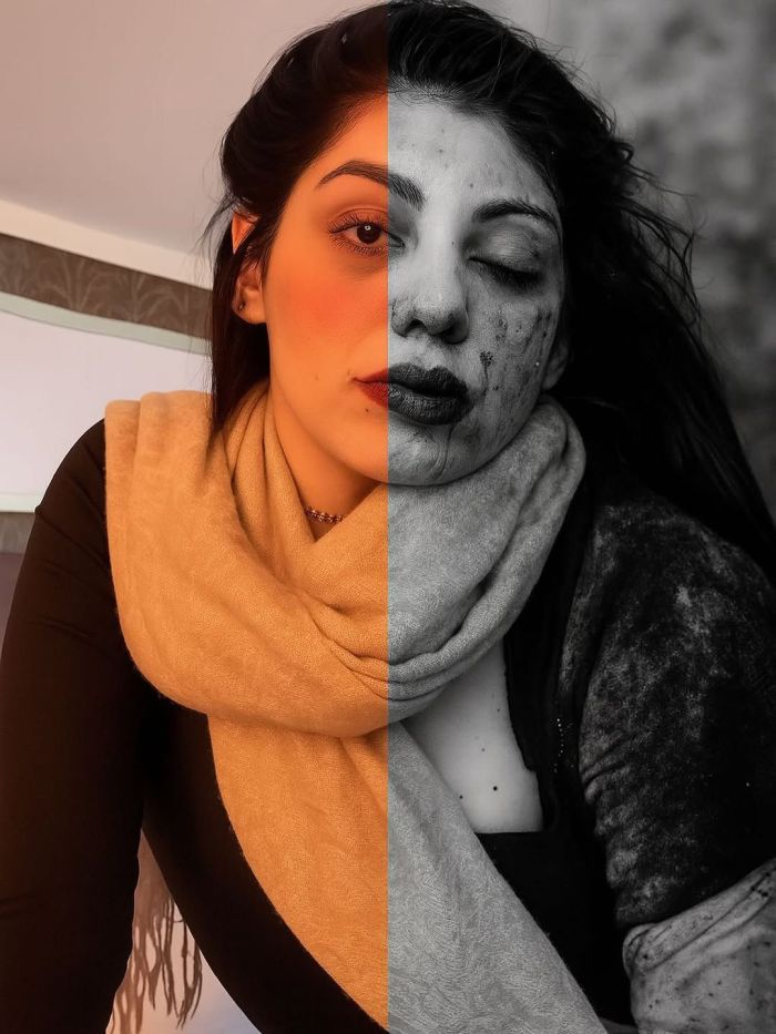 Foto publicada por Samara Mello nas redes sociais junto ao texto expondo a violência doméstica sofrida