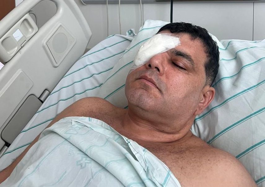 Flamenguista passa por cirurgia no olho no mesmo dia que agressores são soltos: ‘Frustrante’