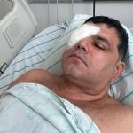 Flamenguista passa por cirurgia no olho no mesmo dia que agressores são soltos: ‘Frustrante’