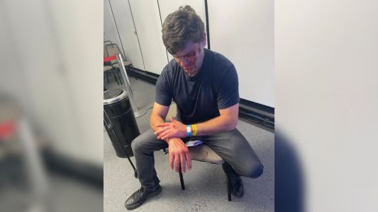 O que se sabe sobre a agressão de assessor de Marçal a marqueteiro de Nunes | CNN Brasil