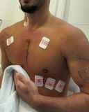 Vittor Fernando exibiu fotos das cicatrizes