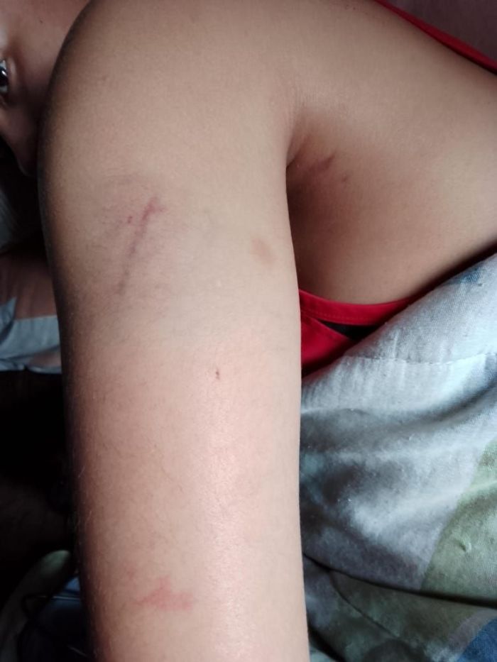 Thallys levou um tapa na cabeça, três no rosto e um chute na costela.
