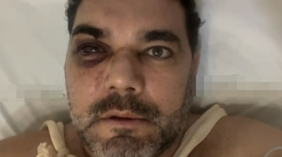 Torcedor do Flamengo agredido vê sociedade doente e cita paixão da família pelo Atlético