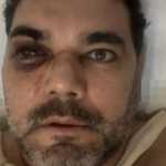 Torcedor do Flamengo agredido vê sociedade doente e cita paixão da família pelo Atlético