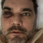 Torcedor do Flamengo agredido vê sociedade doente e cita paixão da família pelo Atlético