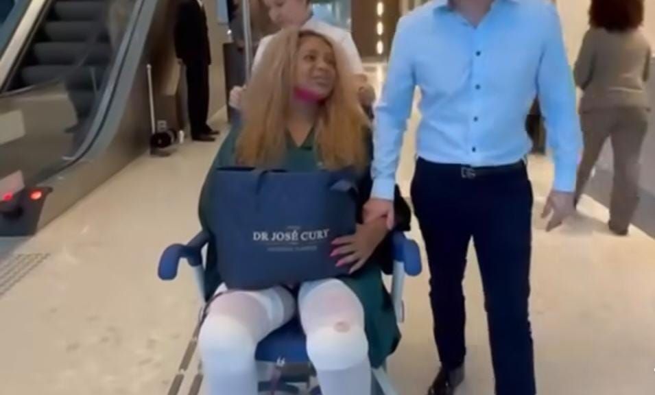 Cariúcha mostra recuperação após cirurgia plástica de 7 horas: ‘não sou mais toda natural’