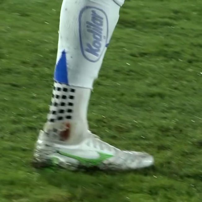 O tornozelo machucado de Dinenno O tornozelo machucado de Dinenno