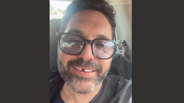 Cantor Edson mostrou que perdeu o dente ao roer um osso de frango caipira