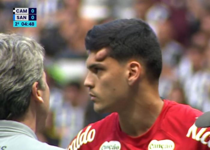 Cabeça de Gabriel Brazão