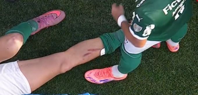 Fuchs sofreu entrada forte de Pulgar e ficou com marca na perna