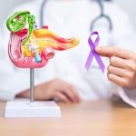 Estudo brasileiro aponta proteína como responsável pelo avanço agressivo do câncer de pâncreas