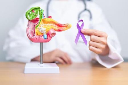 Cancer de pancreas