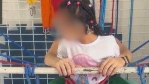 Justiça nega pedido de tratamento especializado para criança com síndrome rara em Ouro Preto