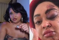 Ex-BBB Rizia revela que perdeu a memória após acidente com moto elétrica