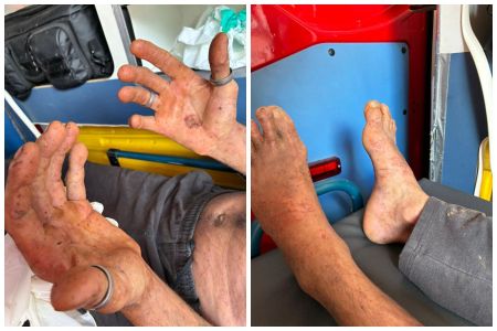 • Reprodução / Corpo de Bombeiros