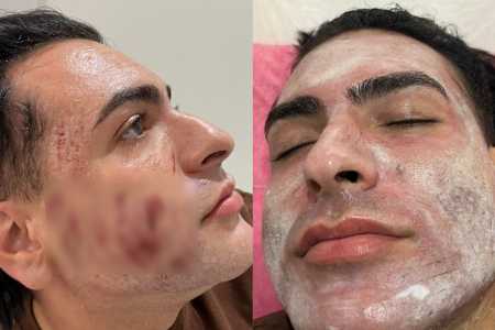 Imagens foram registradas pelo marido da vítima durante o procedimento • Reprodução | Redes Sociais