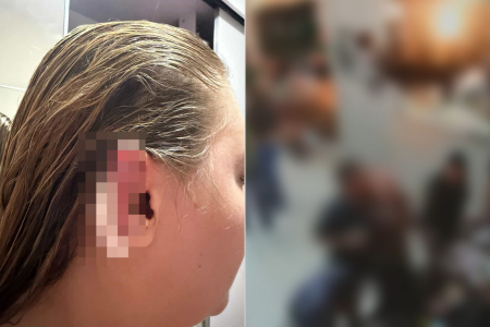 Mulher ficou com ferimentos após a ação do companheiro