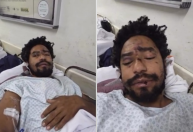 Ator denuncia agressão motivada por homofobia em adega no centro de SP