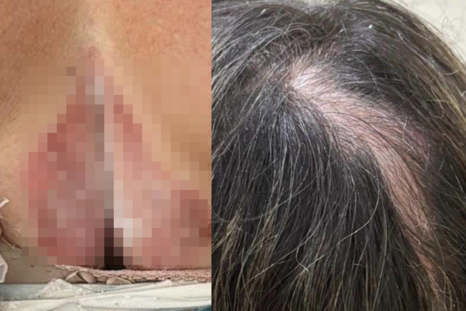 Homem é preso por tentar incendiar pai e madrasta após briga por lote na Grande BH