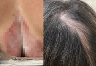 Homem é preso por tentar incendiar pai e madrasta após briga por lote na Grande BH