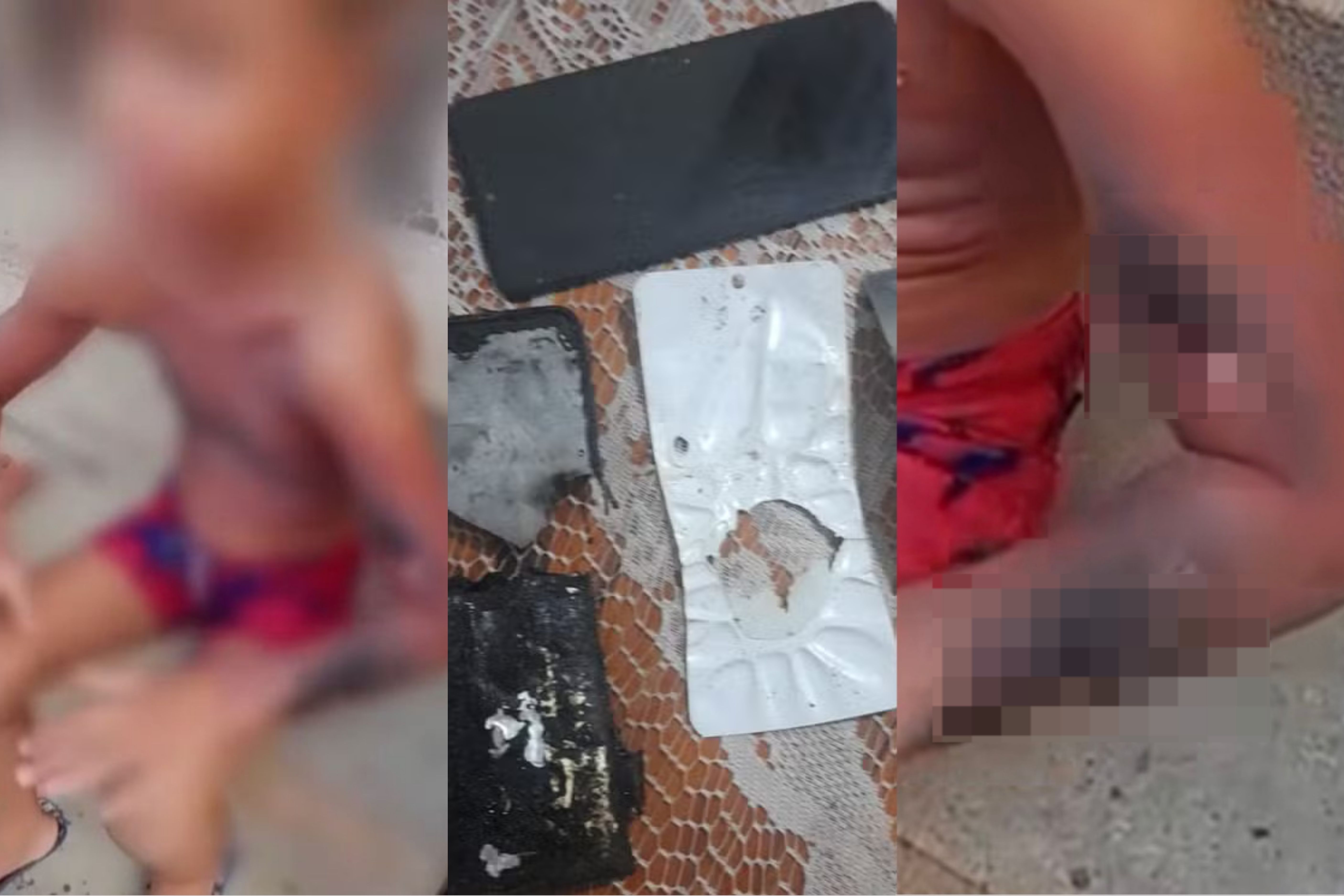 Celular explode enquanto carregava, e criança de seis anos fica ferida no Recife