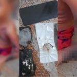 Celular explode enquanto carregava, e criança de seis anos fica ferida no Recife