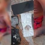 Celular explode enquanto carregava, e criança de seis anos fica ferida no Recife